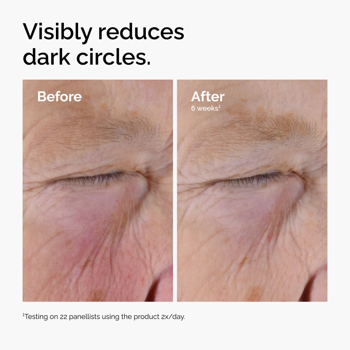 caffeine-solution-5-egcg-eye-serum-e6 ord-caffeine-solution-egcg-dark-circles-before-after.jpg