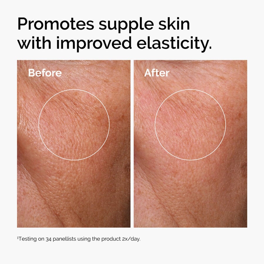 hyaluronic-acid-2-b5-with-ceramides-g9 ord-hyaluronic-acid-2pct-b5-hydrating-serum-before-after-elasticity.jpg