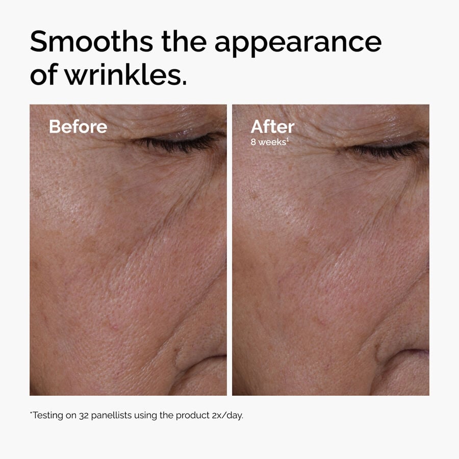 multi-peptide-ha-serum-h1 ord-multi-peptide-ha-serum-wrinkles-before-after.jpg