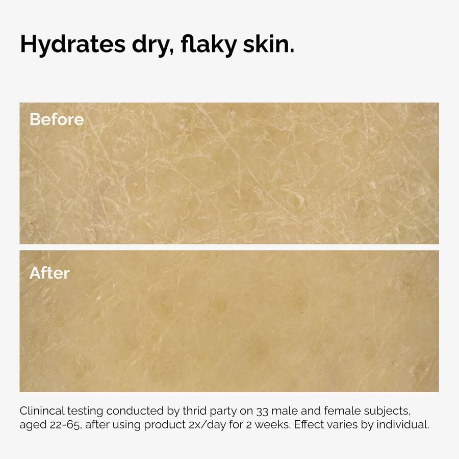 the-body-care-collection-m0 ord-natural-moisturizing-factors-inulin-body-before-after-graphic-02.jpg