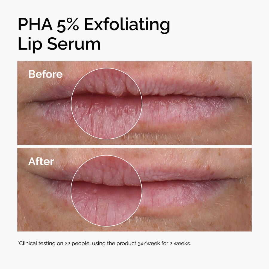 pha-5-exfoliating-lip-serum-j1 ord-pha-5pct-lip-exfoliating-serum-before-after.jpg