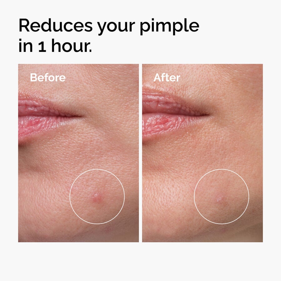 sulfur-10-powder-to-cream-concentrate-r2 ord-sulfur-10pct-powder-to-cream-concentrate-before-after-NA.jpg